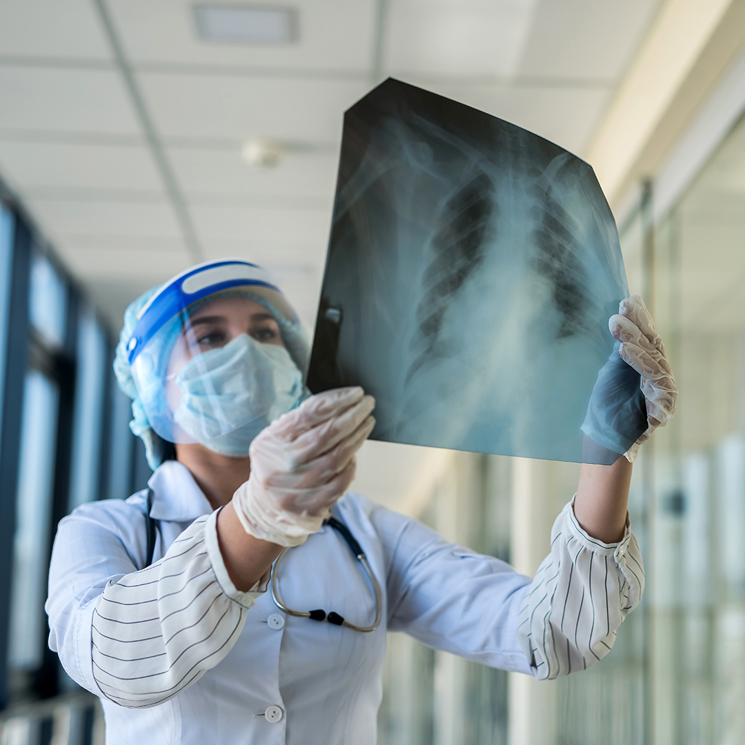 Technician holding up chest x-ray